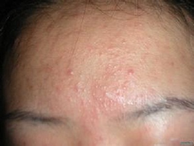 Ԥ���ഺ�����ճ�����