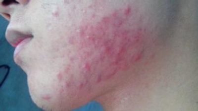 �ഺ������Ԥ����