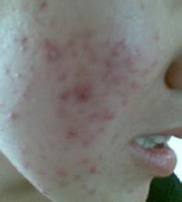 ����Ԥ���ഺ��