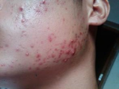 �ഺ������Щ֢״����