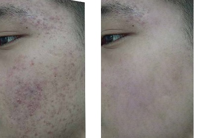 ���������ഺ��Ӧ��λ���