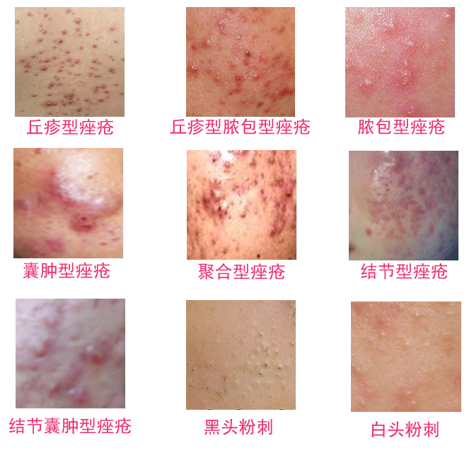 �ഺ�����Ʒ����Ƕ���Ǯ